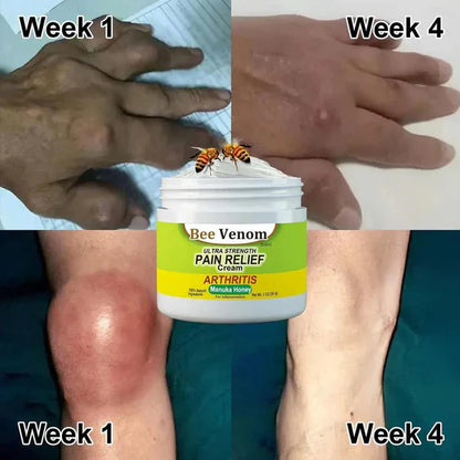 Bee Venom Joint and Bone Therapy Cream